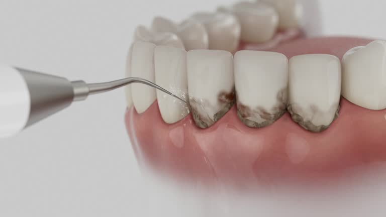 Reliable Tooth Extraction contractor in Dayton, IN by Smile Center Dentistry